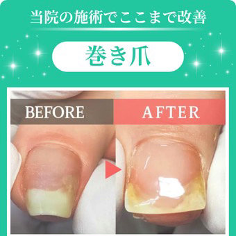 kitasenju.makidume.fulfill