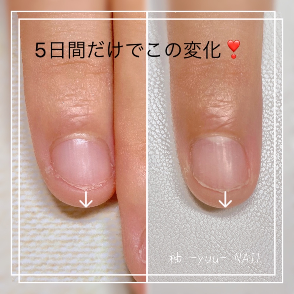 yuu_nail.Momoko