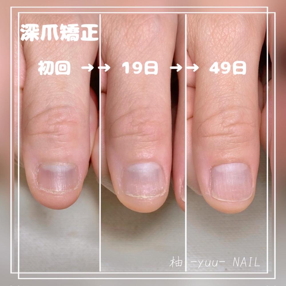 yuu_nail.Momoko