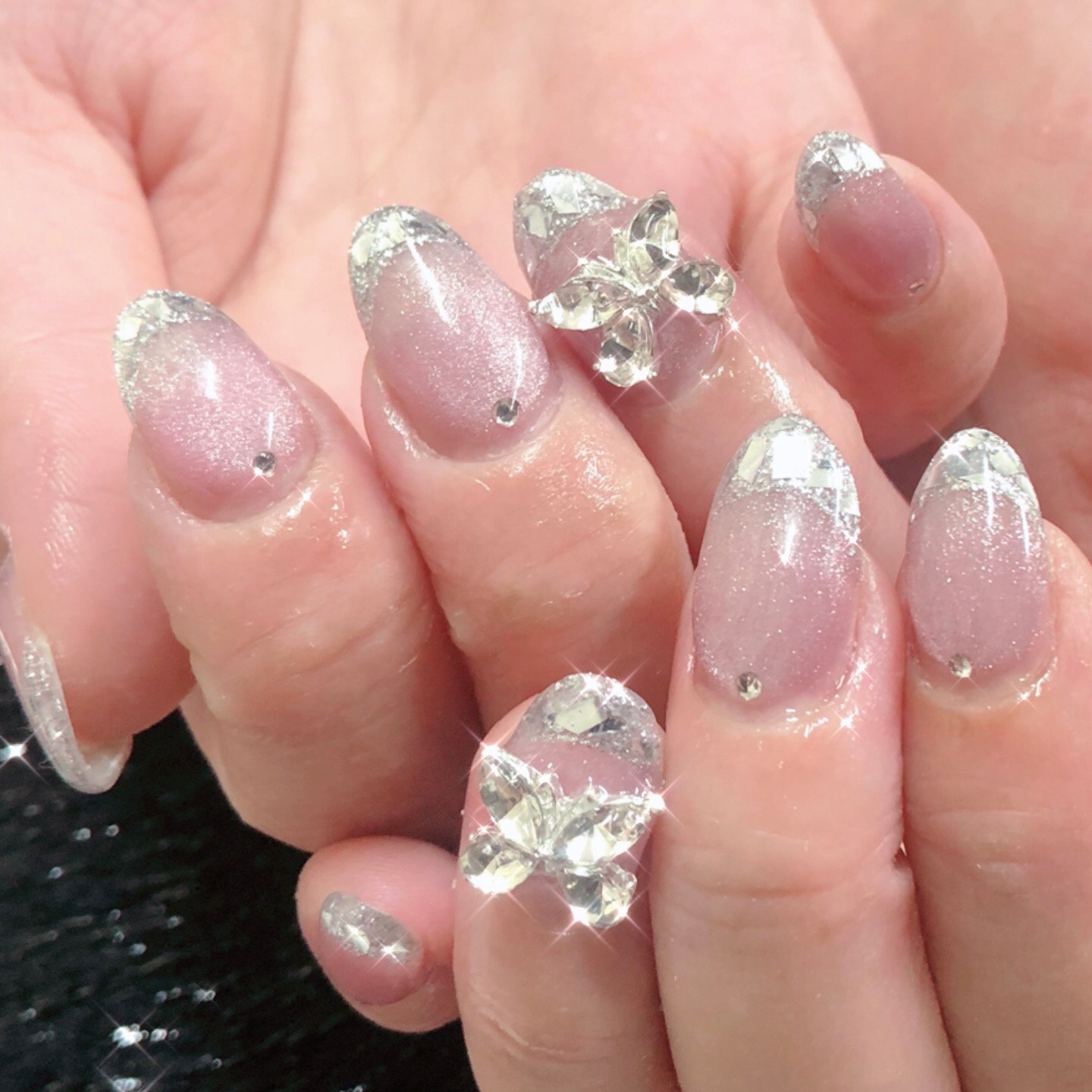 ForU_Lovely_scalpnail