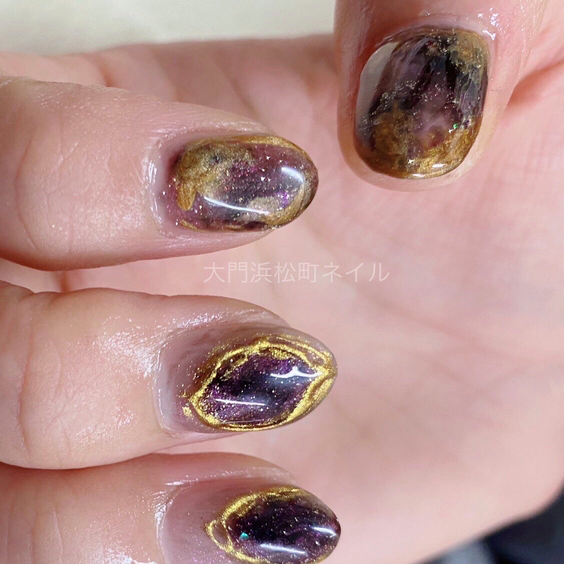 ForU_Lovely_scalpnail