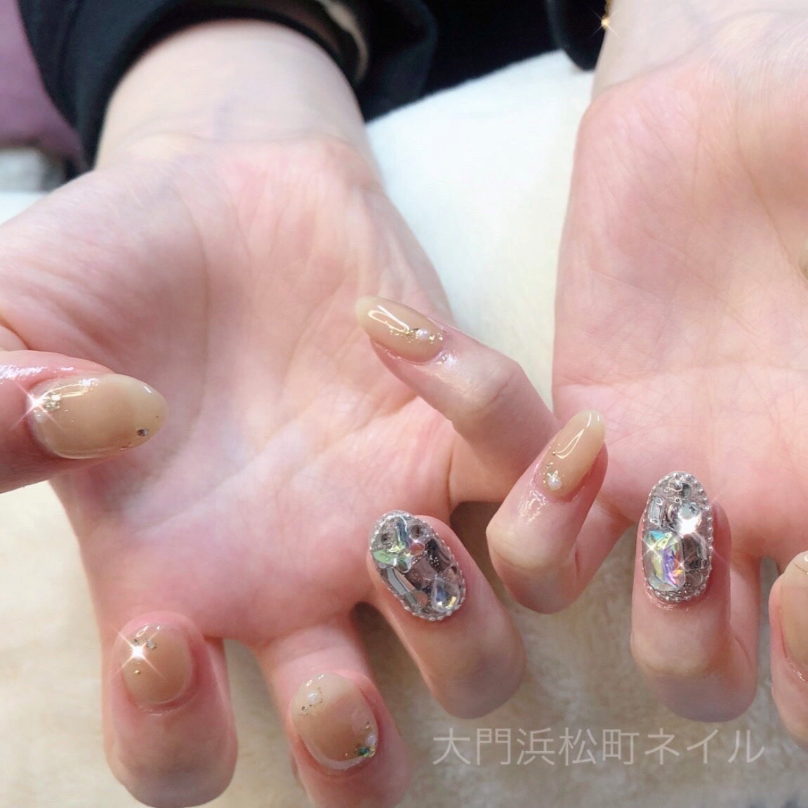 ForU_Lovely_scalpnail