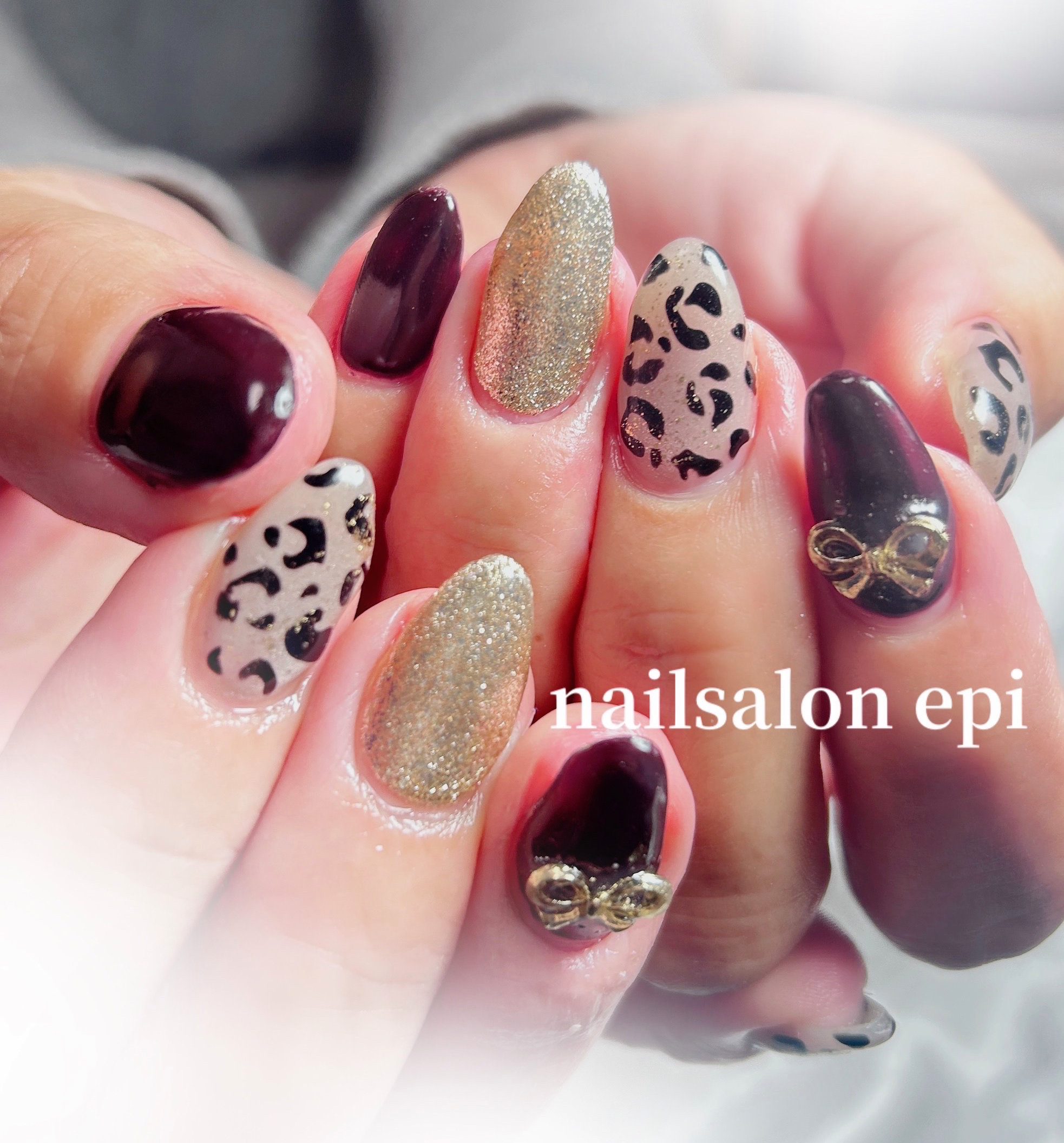 nail.epi